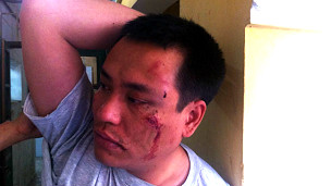 Nguyễn Chí Đức bị hành hung