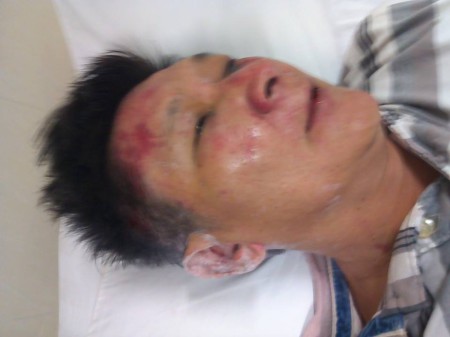 Nhà báo Trương Minh Đức nhiều lần bị đánh đập dã man.