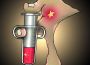 Đảng Ba Đình chích thuốc liệt kháng cho Việt Nam