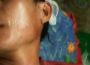 Nghệ An: Công an nổ súng trấn áp giáo dân